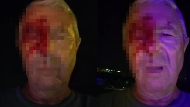 Kocaeli'de Olay Yeri Saldırısına Uğrayan Muhabir Yaralandı