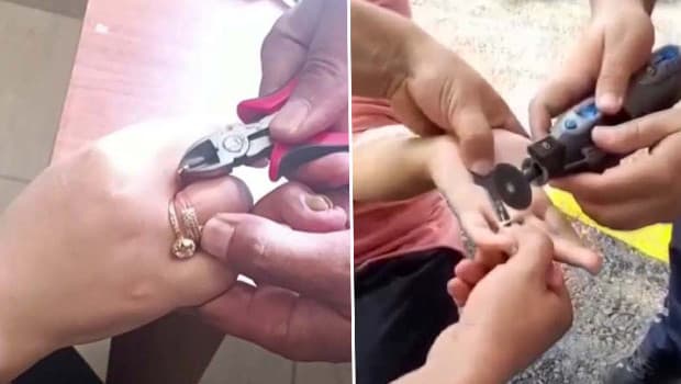 Parmaklarına sıkışan yüzükleri itfaiye çıkardı